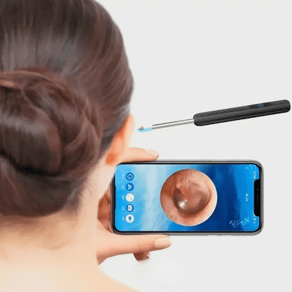 OídoPlus – Salud auditiva avanzada con limpieza profunda